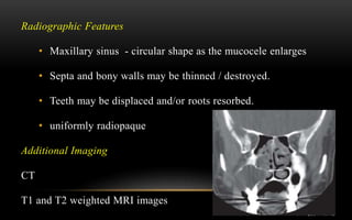 Differential diagnosis of haziness of maxillary sinus | PPTX