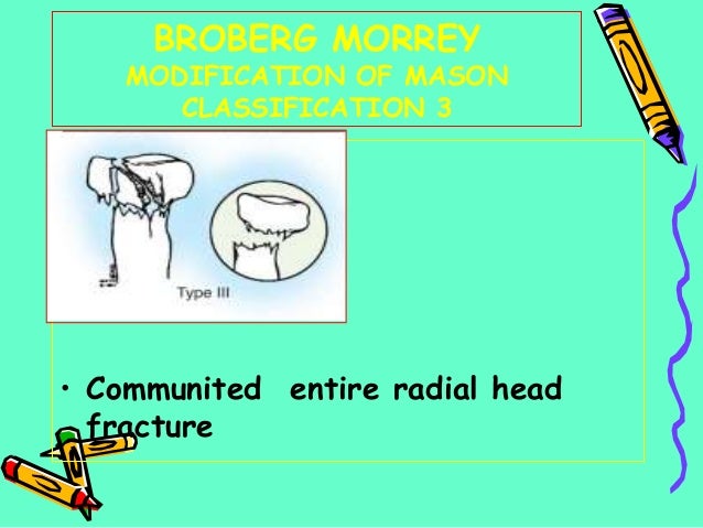 Radial Head Fracture Classification