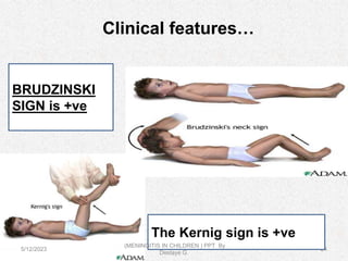 11meningits ppt(1).pptx