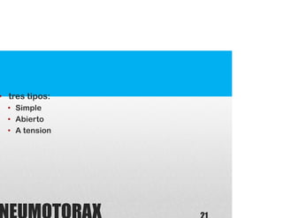 • tres tipos:
• Simple
• Abierto
• A tension
 