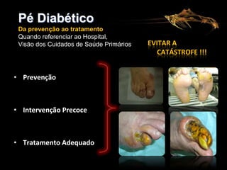 Pé Diabético
Da prevenção ao tratamento
Quando referenciar ao Hospital,
Visão dos Cuidados de Saúde Primários

• Prevenção

• Intervenção Precoce

• Tratamento Adequado

EVITAR A
CATÁSTROFE !!!

 