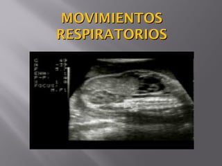 MOVIMIENTOSMOVIMIENTOS
RESPIRATORIOSRESPIRATORIOS
 