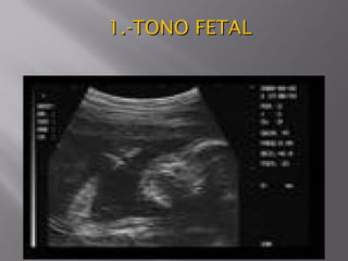 1.-TONO FETAL1.-TONO FETAL
 