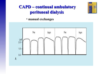 CAPD – continual ambulatory peritoneal dialysis  manual exchanges  