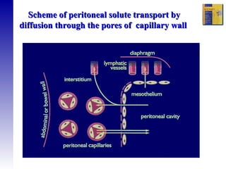 Scheme of peritoneal solute transport by diffusion through the pores of  capillary wall  
