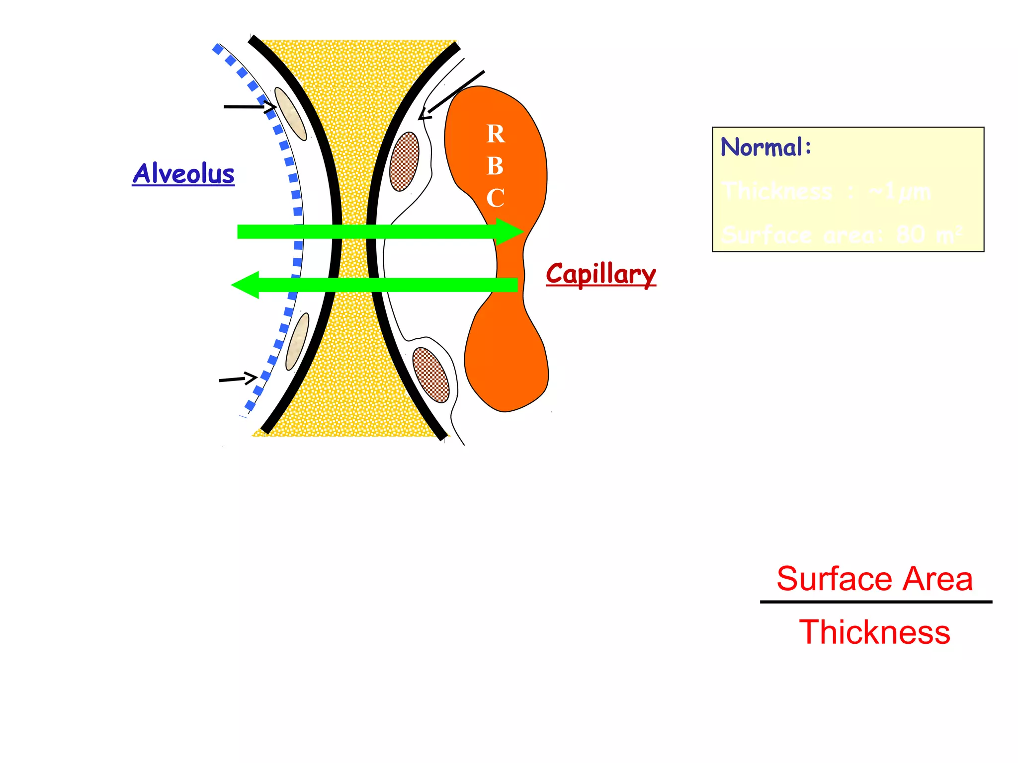 Structure of Alveolar-Capillary Membrane
(Diffusion Membrane)
Diffusion Speed∝
Surface Area
Thickness
Alveolus
R
B
C
Capillary
Normal:
Thickness ： ~1µm
Surface area: 80 m2
O2
CO2
Epithelium
Surfactant
Endothelium
 