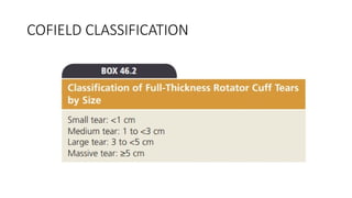Comprehensive Overview of Rotator Cuff Tears: Anatomy, Diagnosis, and ...