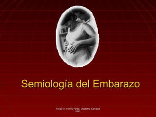 Semiología del EmbarazoSemiología del Embarazo..
Felipe A. Flores Pérez. Obstetra SanidadFelipe A. Flores Pérez. Obstetra Sanidad
PNP.PNP.
 