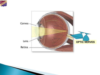 OPTIC NERVES 