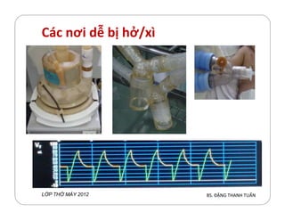 Các nơi dễ bị hở/xì
BS. ĐẶNG THANH TUẤNL P TH MÁY 2012
 