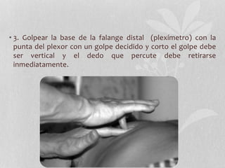 • 3. Golpear la base de la falange distal (plexímetro) con la
punta del plexor con un golpe decidido y corto el golpe debe
ser vertical y el dedo que percute debe retirarse
inmediatamente.
 