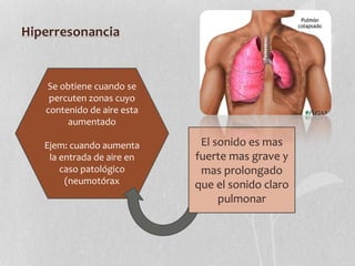 Hiperresonancia
Se obtiene cuando se
percuten zonas cuyo
contenido de aire esta
aumentado
Ejem: cuando aumenta
la entrada de aire en
caso patológico
(neumotórax
El sonido es mas
fuerte mas grave y
mas prolongado
que el sonido claro
pulmonar
 