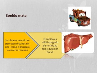 Sonido mate
Se obtiene cuando se
percuten órganos sin
aire como el musculo
o vísceras macizas
El sonido es
débil apagado
de tonalidad
alta y duración
breve
 