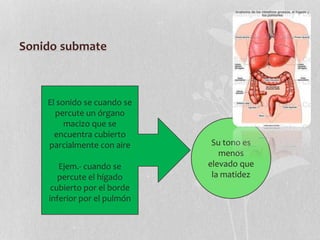 Sonido submate
El sonido se cuando se
percute un órgano
macizo que se
encuentra cubierto
parcialmente con aire
Ejem.- cuando se
percute el hígado
cubierto por el borde
inferior por el pulmón
Su tono es
menos
elevado que
la matidez
 
