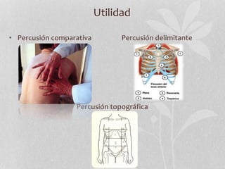 Utilidad
• Percusión comparativa Percusión delimitante
Percusión topográfica
 