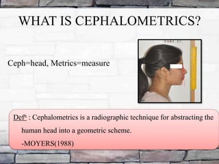 Cepalometrics | PPTX