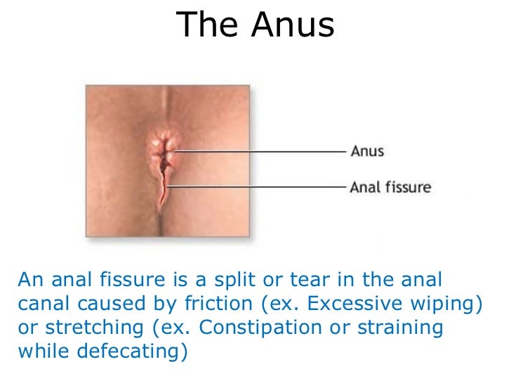 Anal stretching treat constipation