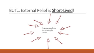 BUT… External Relief is Short-Lived!
Eczema manifests
from multiple
factors.
 