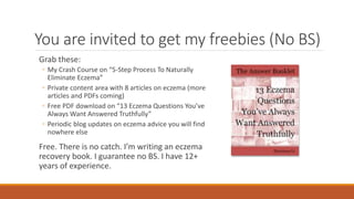You are invited to get my freebies (No BS)
Grab these:
◦ My Crash Course on “5-Step Process To Naturally
Eliminate Eczema”
◦ Private content area with 8 articles on eczema (more
articles and PDFs coming)
◦ Free PDF download on “13 Eczema Questions You’ve
Always Want Answered Truthfully”
◦ Periodic blog updates on eczema advice you will find
nowhere else
Free. There is no catch. I’m writing an eczema
recovery book. I guarantee no BS. I have 12+
years of experience.
 