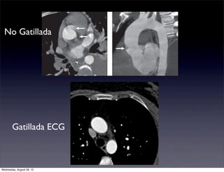 No Gatillada

Gatillada ECG

Wednesday, August 28, 13

 