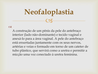 Neofaloplastia
                 

    A construção de um pênis da pele do antebraço
    interior (lado não-dominante) e tecido vaginal e
    anexá-lo para a área vaginal. A pele do antebraço
    está enxertadas juntamente com os seus nervos,
    artérias e veias e formado em torno de um cateter de
    tubo plástico, que servirá como a uretra e permitir a
    micção uma vez conectado à uretra feminina.
 