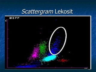Scattergram  Lekosit  