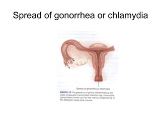 Spread of gonorrhea or chlamydia

 