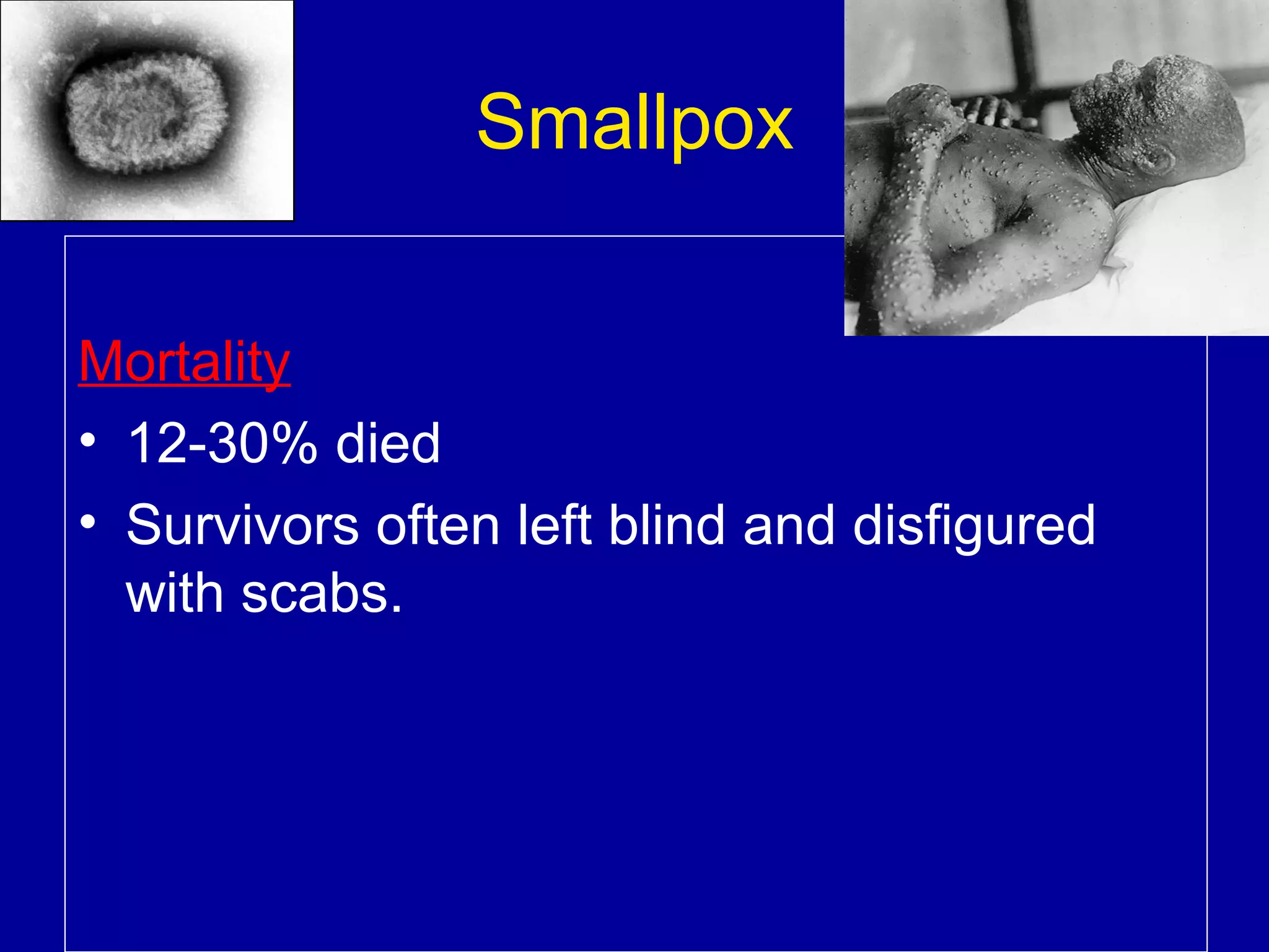 Smallpox
Mortality
• 12-30% died
• Survivors often left blind and disfigured
with scabs.

 