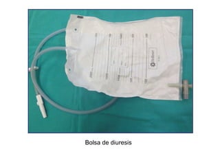 Bolsa de diuresis

 