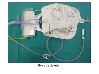 Bolsa de diuresis

 
