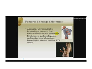 12.  parto pretermino - tocolisis
