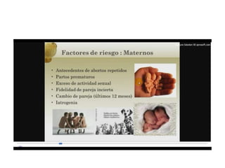 12.  parto pretermino - tocolisis