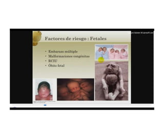 12.  parto pretermino - tocolisis