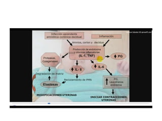 12.  parto pretermino - tocolisis