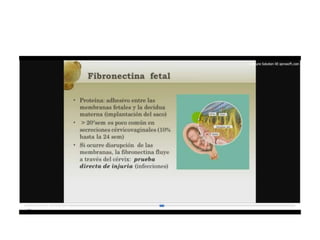 12.  parto pretermino - tocolisis