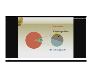 12.  parto pretermino - tocolisis