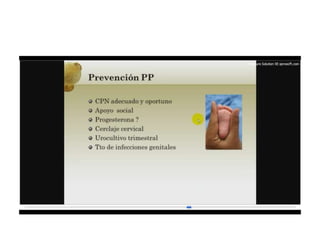 12.  parto pretermino - tocolisis
