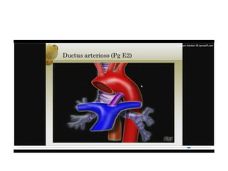 12.  parto pretermino - tocolisis