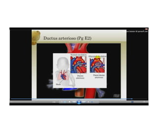 12.  parto pretermino - tocolisis