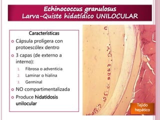 22 
Características 
 Cápsula prolígera con 
protoescólex dentro 
 3 capas (de externo a 
interno): 
1. Fibrosa o adventicia 
2. Laminar o hialina 
3. Germinal 
 NO compartimentalizada 
 Produce hidatidosis 
unilocular Tejido 
hepático 
 