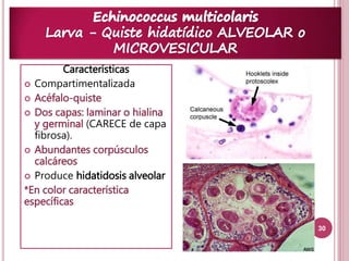 30 
Características 
 Compartimentalizada 
 Acéfalo-quiste 
 Dos capas: laminar o hialina 
y germinal (CARECE de capa 
fibrosa). 
 Abundantes corpúsculos 
calcáreos 
 Produce hidatidosis alveolar 
*En color característica 
específicas 
 