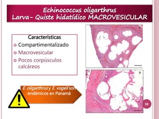 50 
Características 
 Compartimentalizado 
 Macrovesicular 
 Pocos corpúsculos 
calcáreos 
E. oligarthrus y E. vogeli son 
endémicos en Panamá 
 