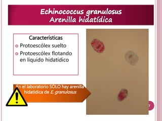 7 
Características 
 Protoescólex suelto 
 Protoescólex flotando 
en líquido hidatídico 
En el laboratorio SÓLO hay arenilla 
hidatidica de E. granulosus 
 