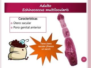 77 
Características 
 Útero sacular 
 Poro genital anterior 
Tiene útero 
sacular (¡Parece 
un saco!) 
 