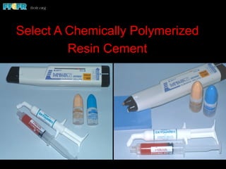 Select A Chemically Polymerized
Resin Cement
 