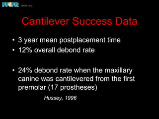 Cantilever Success Data
•  3 year mean postplacement time
•  12% overall debond rate
•  24% debond rate when the maxillary
canine was cantilevered from the first
premolar (17 prostheses)
Hussey, 1996
 
