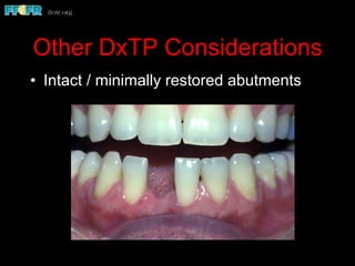 Other DxTP Considerations
•  Intact / minimally restored abutments
 