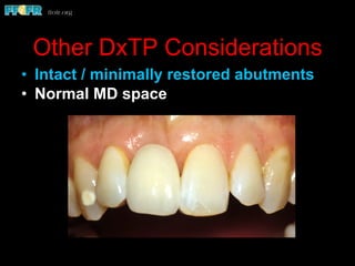 Other DxTP Considerations
•  Intact / minimally restored abutments
•  Normal MD space
 