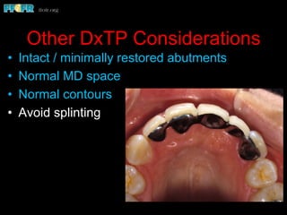 Other DxTP Considerations
•  Intact / minimally restored abutments
•  Normal MD space
•  Normal contours
•  Avoid splinting
 