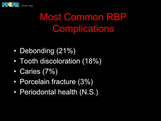Most Common RBP
Complications
•  Debonding (21%)
•  Tooth discoloration (18%)
•  Caries (7%)
•  Porcelain fracture (3%)
•  Periodontal health (N.S.)
 